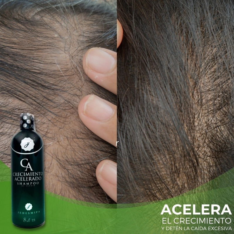 OFERTA: KIT CRECIMIENTO ACELEDADO + 5 POTENCIAS